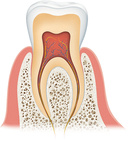 Лечение зубов под общим наркозом ярославль